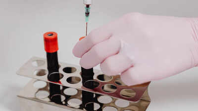 Government has proposed to stop repeated virus testing on plasma-based medicines. india news