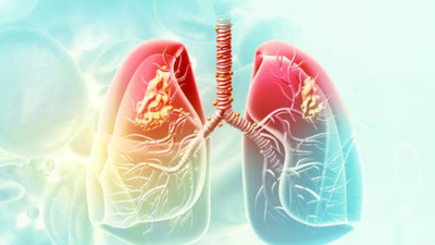 AIIMS-Delhi to study the link between lung cancer and air pollution. india news