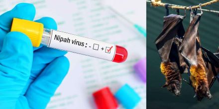 Possibility of Nipah virus: Kyrgyzstan bans testing of animals from India, strict health check at airport