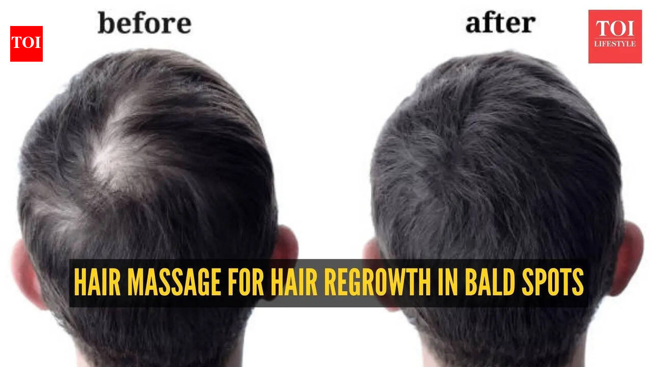 Scalp Massage for Hair Regrowth: For Hair Regrowth: How to Do the Best Scalp Massage for Hair Regrowth in Bald Spots