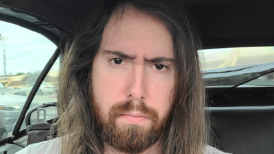 Esmongold Dental Surgery: Esmongold spent $7K on dental surgery during Twitch suspension, says he could “taste the rot”