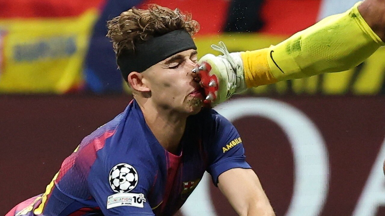 Barcelona vs Atletico Madrid, UEFA Champions League: Fermin Lopez suffers horrific injury in quarter-final