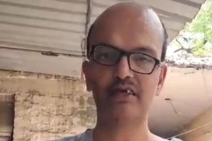 यह सड़क कब बनेगी? सवाल पूछते ही गुस्साए दुकानदार ने शख्स के तीन दांत तोड़ दिए, फिर हाथ में देते हुए कहा- हां बन रहा है.