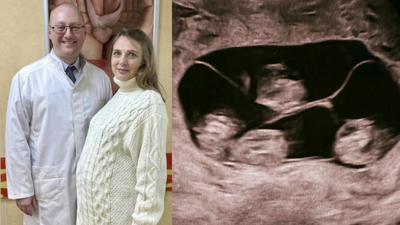 ‘One in 15.5 million’: Woman in Russia gives birth to four identical girls world News