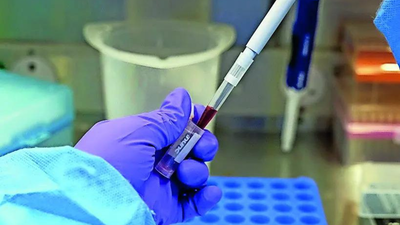 India tightens screening after 2 suspected Ebola cases emerge india news
