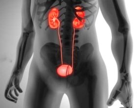 Health Update: High BP is becoming the biggest enemy of kidneys of youth, 80% kidney patients suffer from high blood pressure.