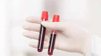 World’s rarest hybrid blood type discovered in Thailand: study found in just 3 people out of massive research of 544,000 samples world News